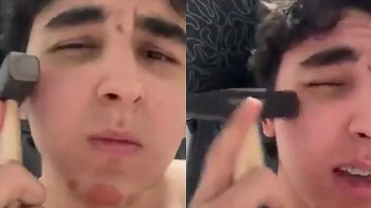 Trendi në Rusi çon në lëndime të më shumë se 100 të rinjve, ata godasin njëri-tjetrin me çekiçë për të pasur mollëza më të mprehta